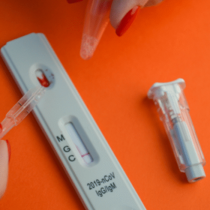 ACA - IGM (Anti Cardiolipin Antibody)