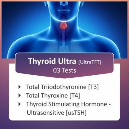Thyroid Profile
